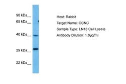 Cyclin C Antibody, Novus Biologicals 100 &mu;L | Buy Online | Novus Biologicals | Fisher Scientific